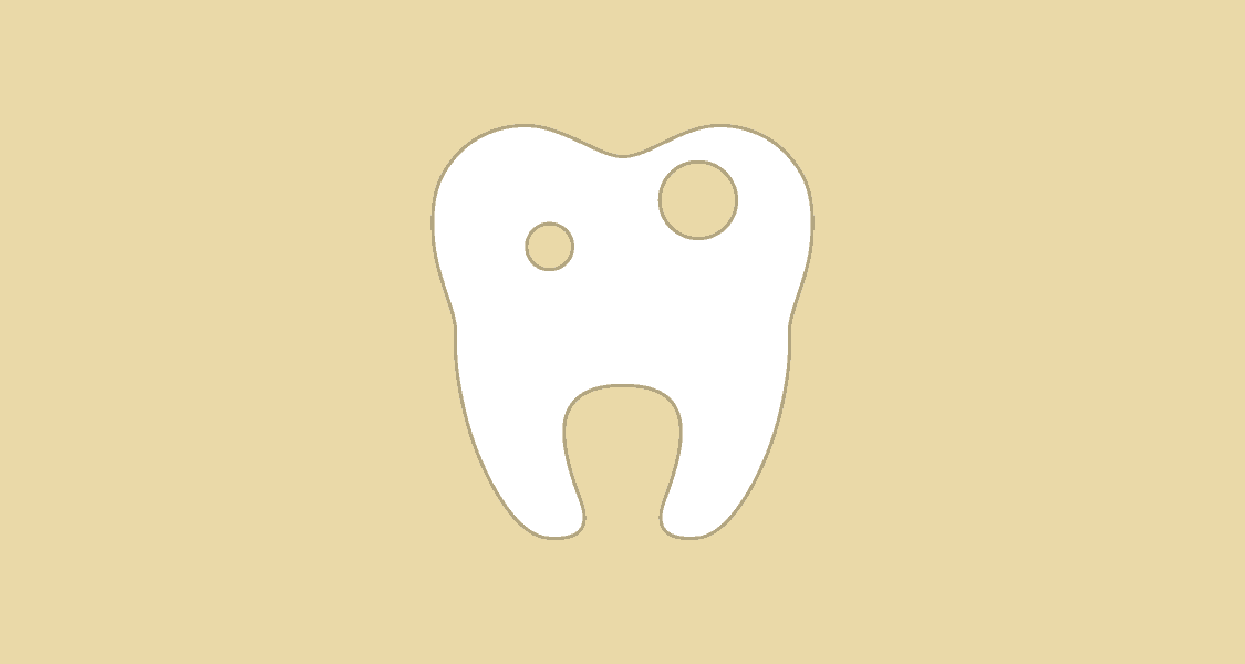 Tandlægehuset Brønderslev - Behandling 02 Huller i tænderne