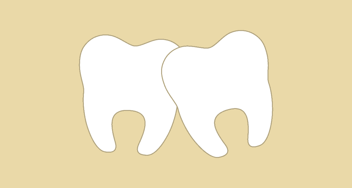 Tandlægehuset Brønderslev - Behandling 12 Skæve tænder