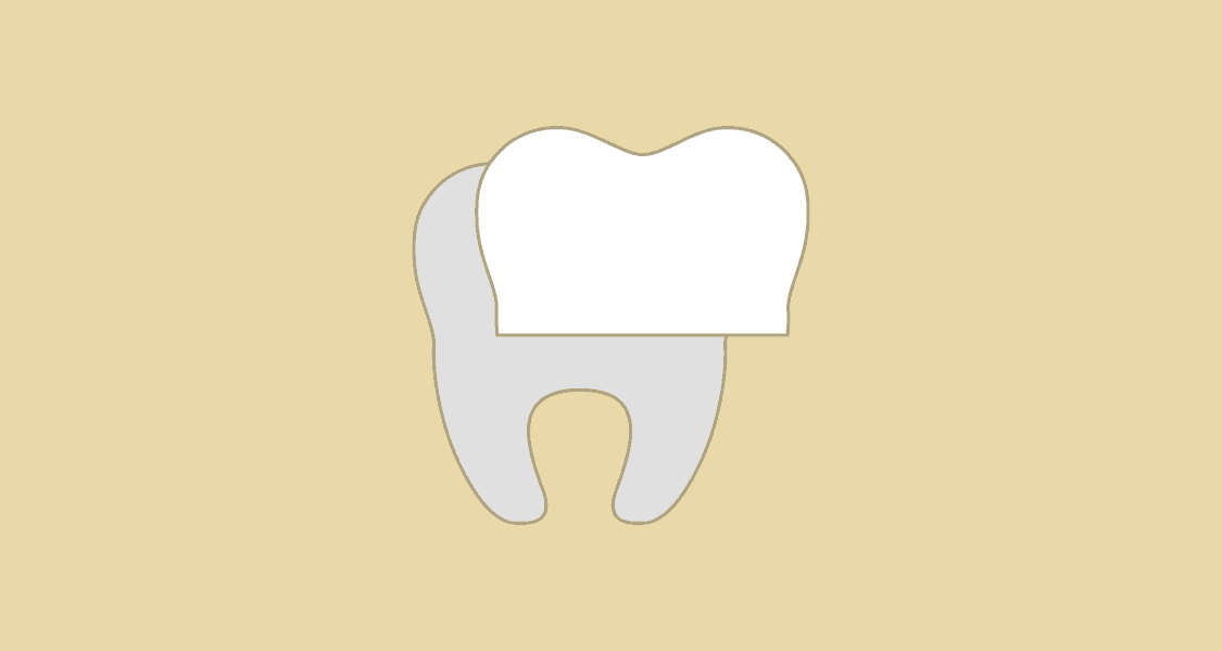Tandlægehuset Brønderslev - Behandling 19 Tandfacader