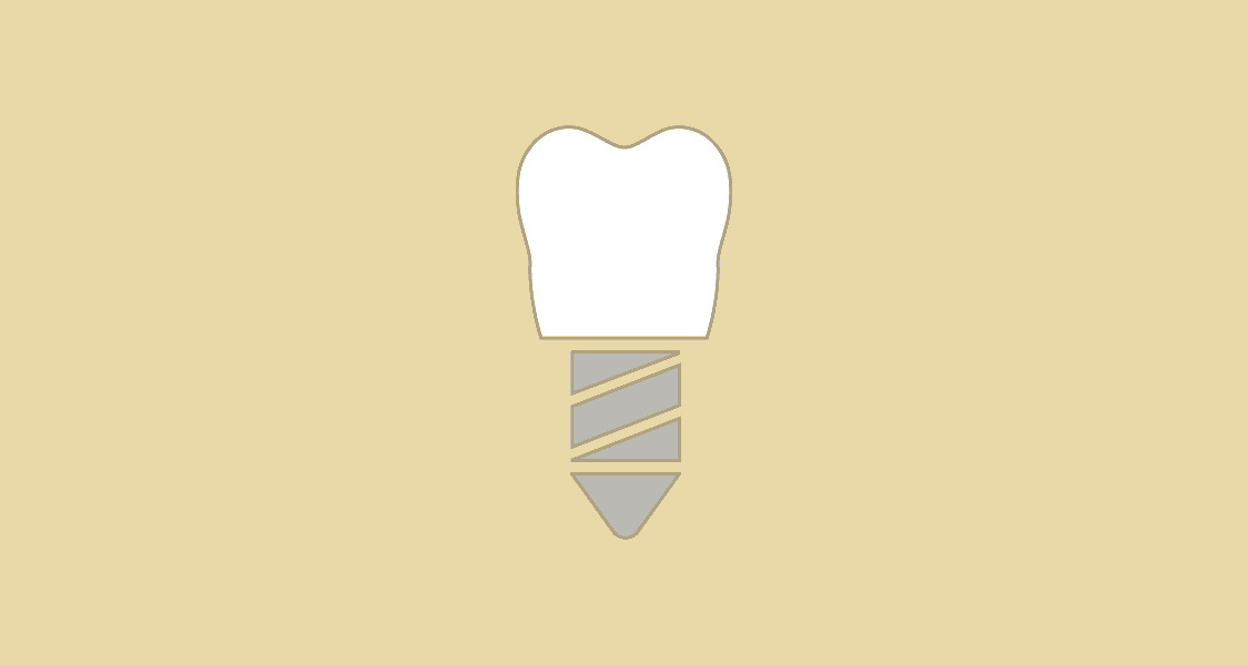 Tandlægehuset Brønderslev - Behandling 21 Tandimplantater