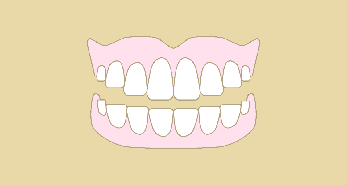 Illustration af tandproteser